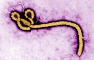 Ученые: Эбола стала передаваться половым путем